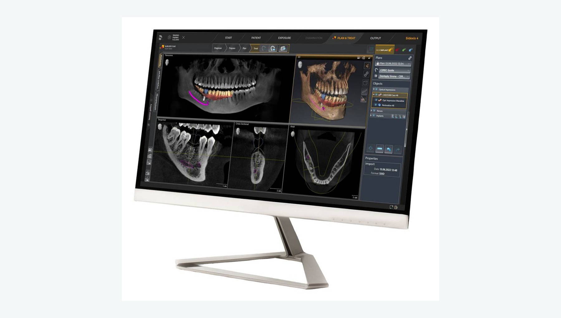 Digital Dental Design Workstation