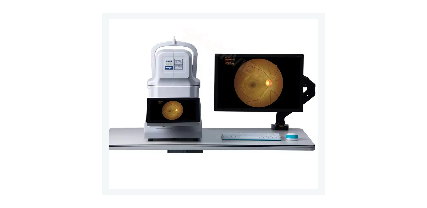 Digital Fundus Camera