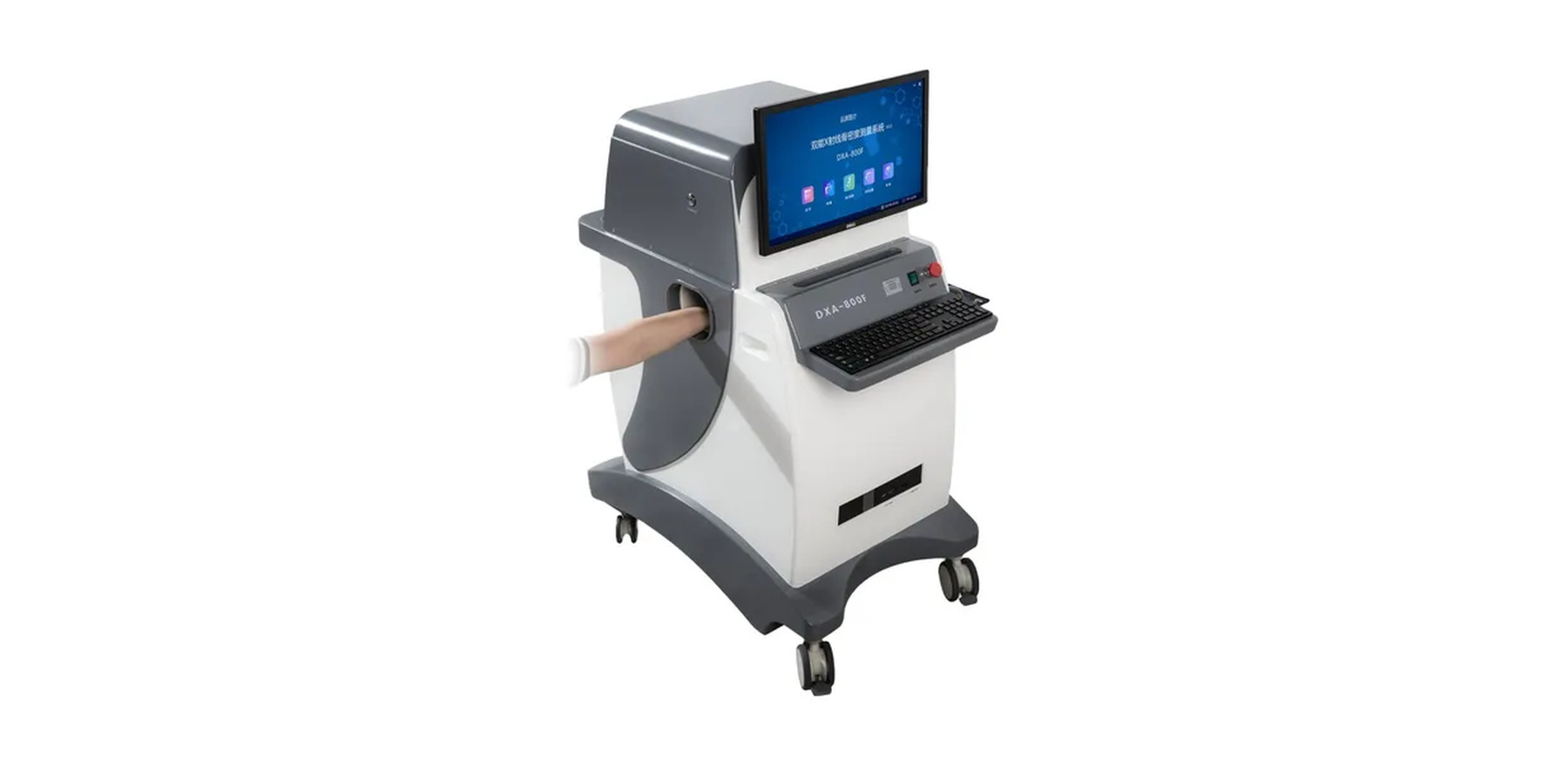 Dual-Energy X-Ray Absorptiometry (DXA) System