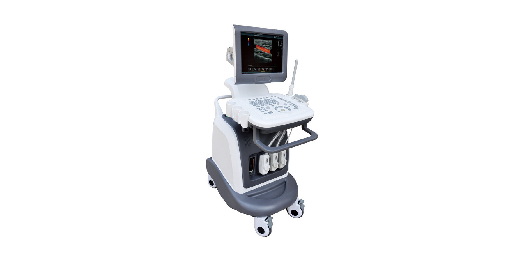 General-Purpose Color Doppler Ultrasound System