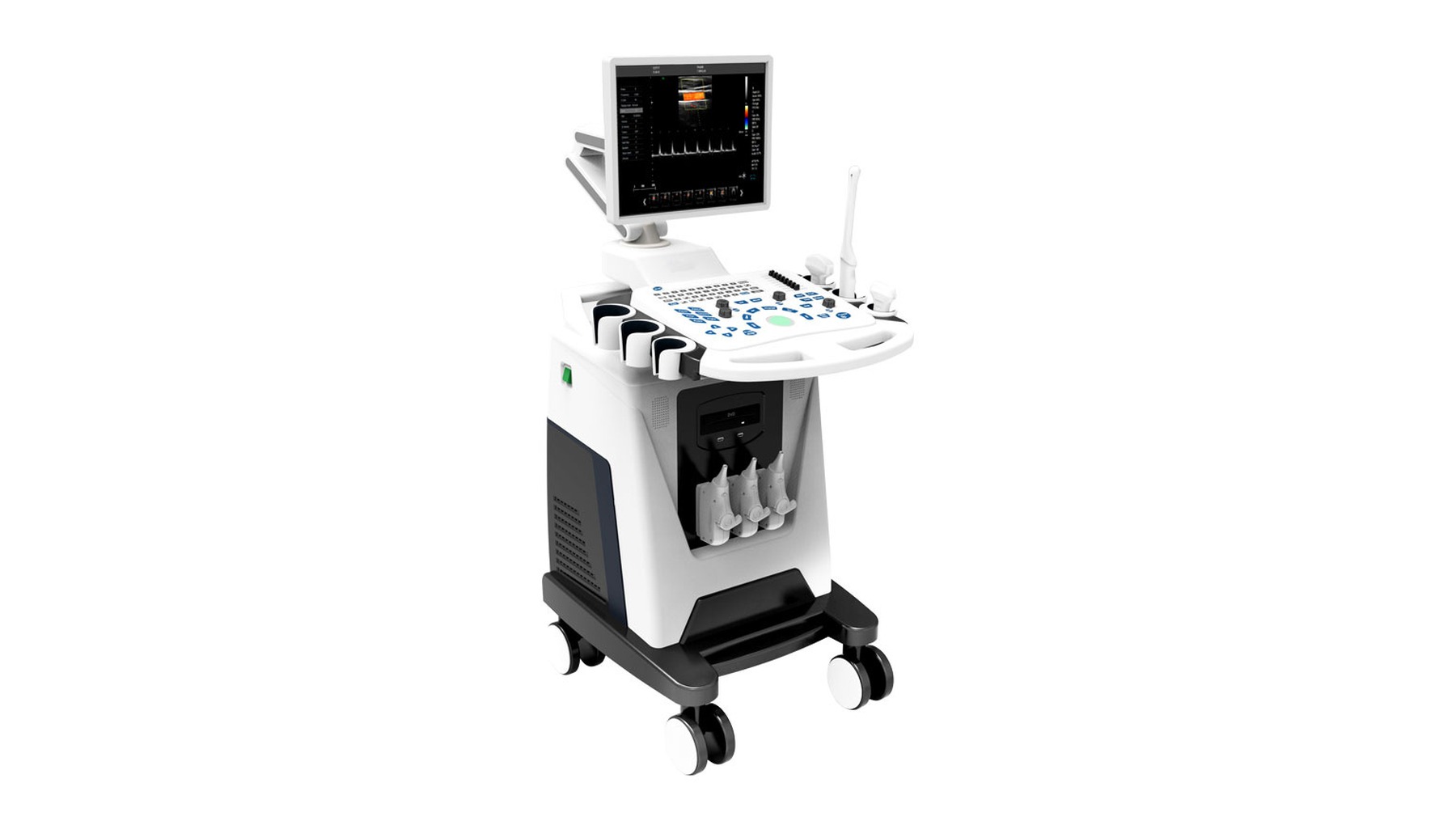 Ultrasound System
